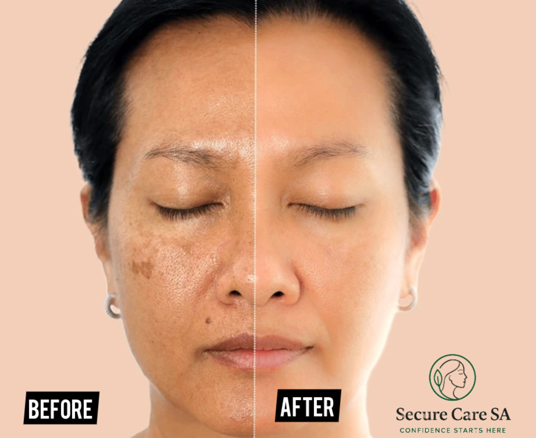 Axis y Dark Spot correcting serum