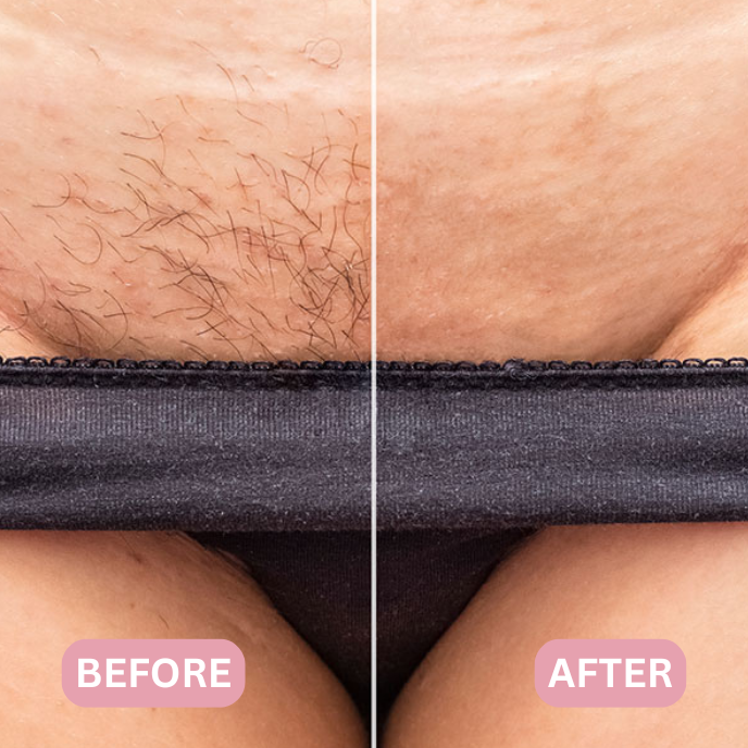 Lunea™ – 2-in-1 Women’s Body Shaver - Imagem 5