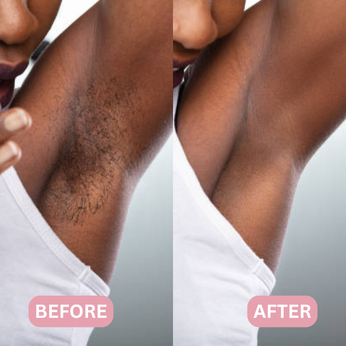 Lunea™ – 2-in-1 Women’s Body Shaver - Imagem 6