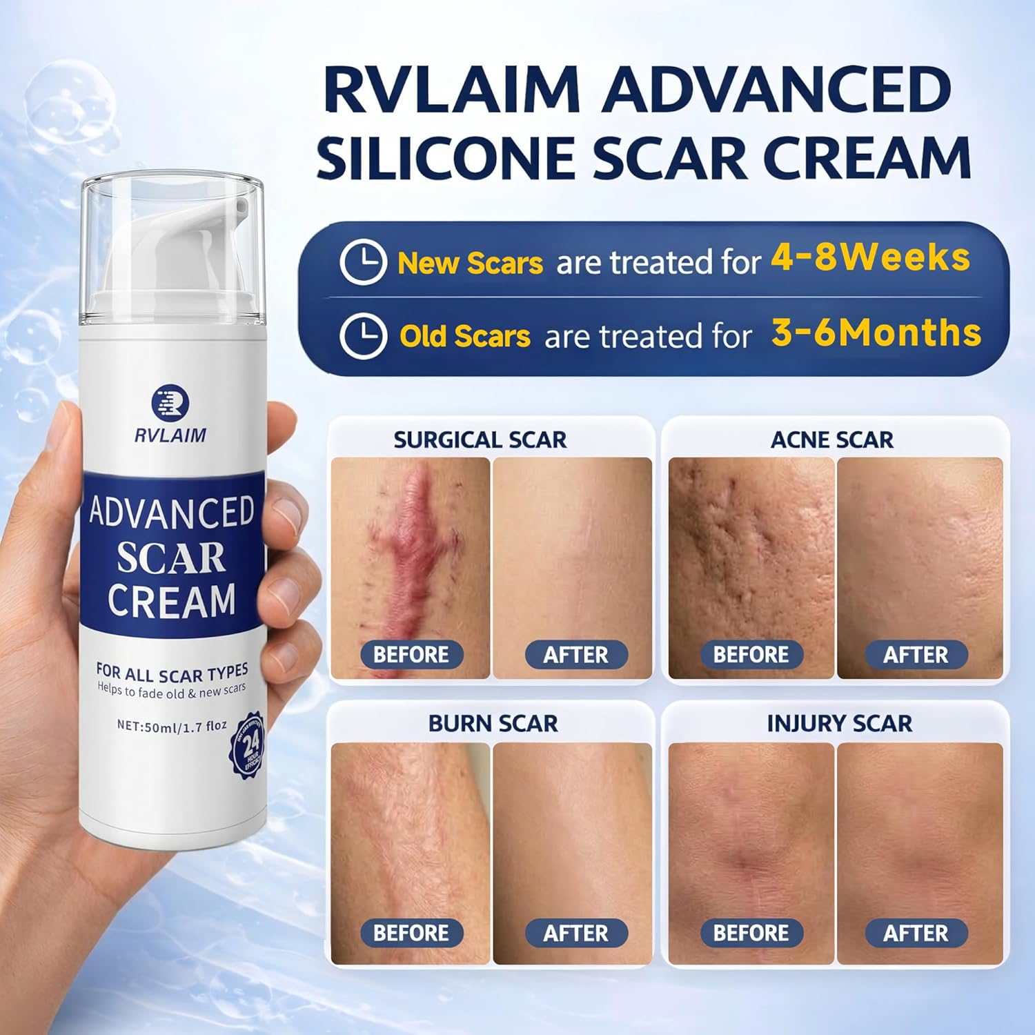 Silicone Scar Cream Scar Gel