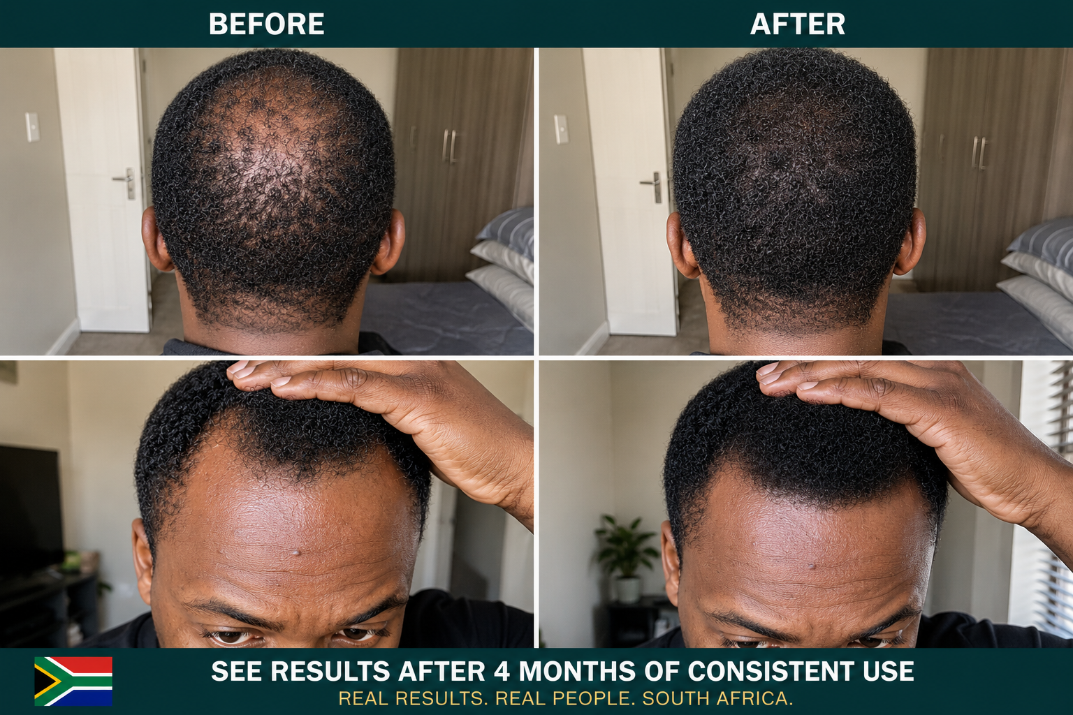 FEG - Hair Regrowth Spray
