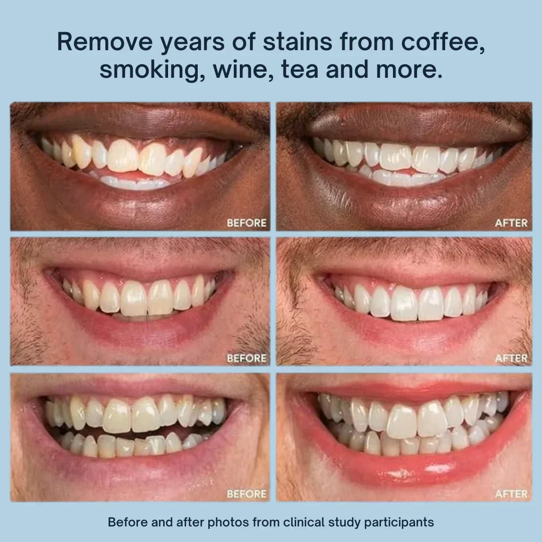 Mirova Teeth Whitening Stick