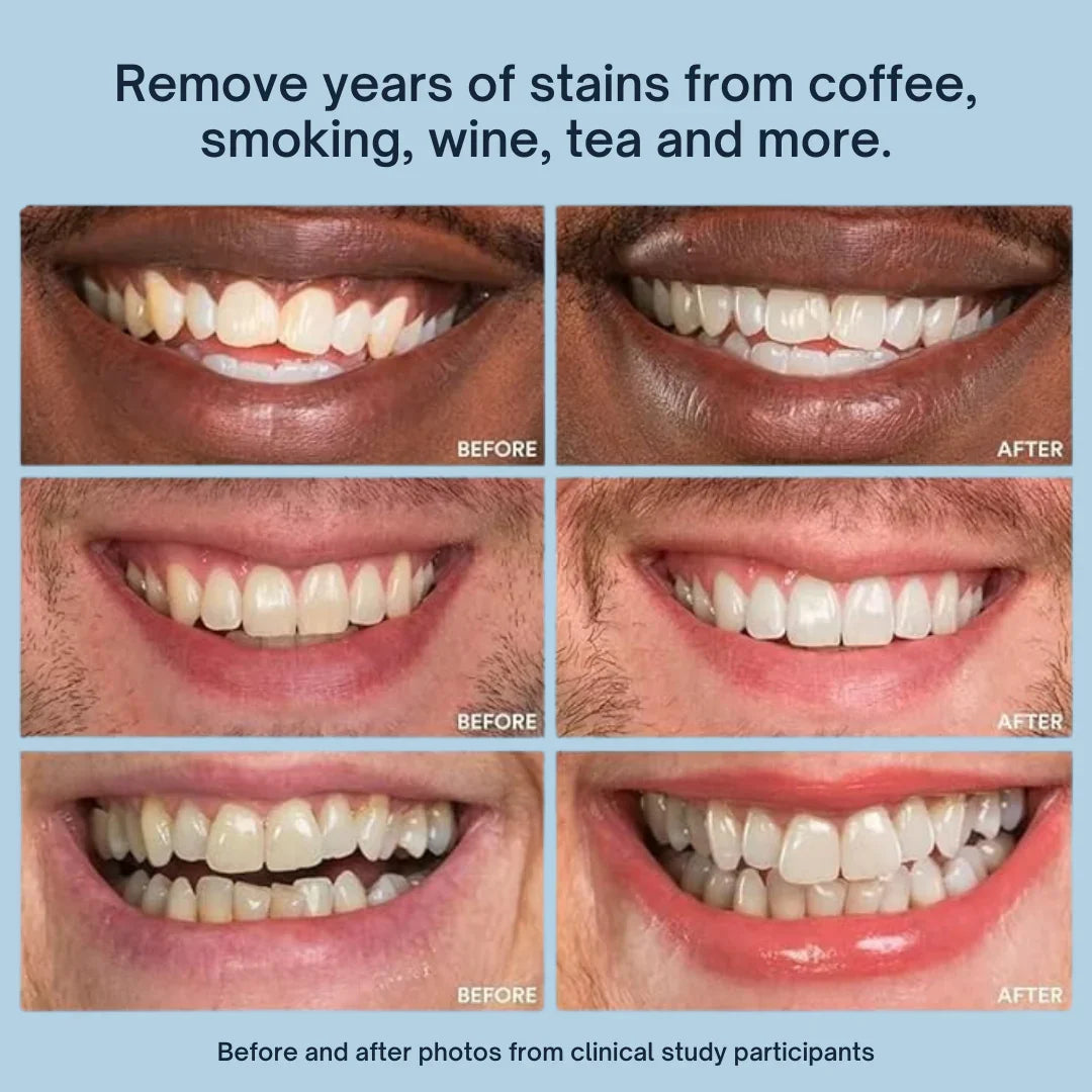 Mirova Teeth Whitening Stick