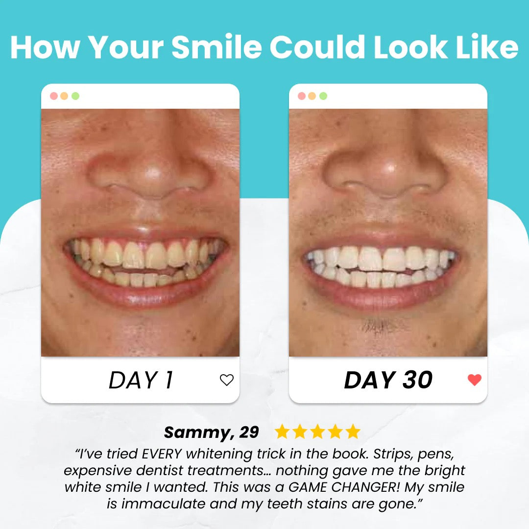 Essential Automatic Toothbrush